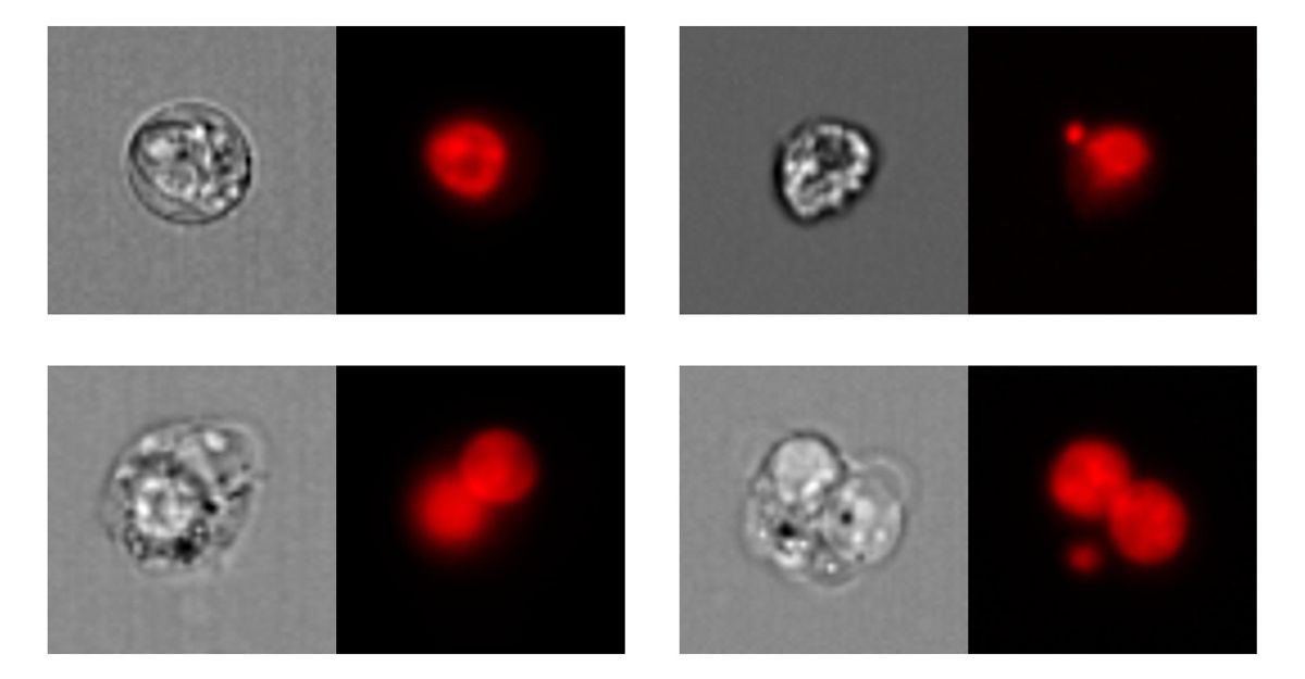 Figure 1. Top left: mononucleated cell; top right: mononucleated cell with micronucleus. Bottom left: binucleated cell; bottom right: binucleated cell with micronucleus. Left: bright-field images; right: nuclear fluorescence images. 