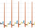 Signal processing data example