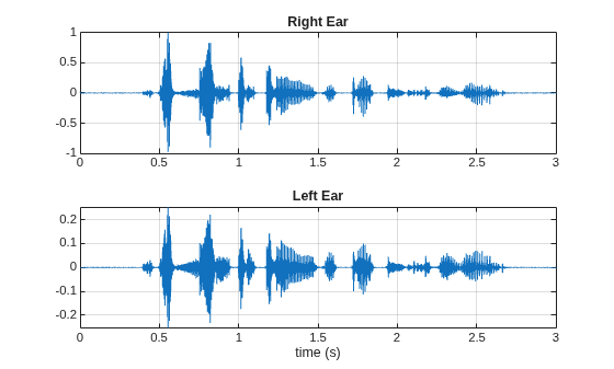 Figure contains 2 axes objects. Axes object 1 with title Right Ear contains an object of type line. Axes object 2 with title Left Ear, xlabel time (s) contains an object of type line.