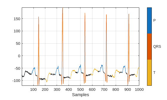 Waveform Segmentation Using Deep Learning