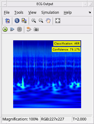 Code Generation for a Deep Learning Simulink Model to Classify ECG Signals