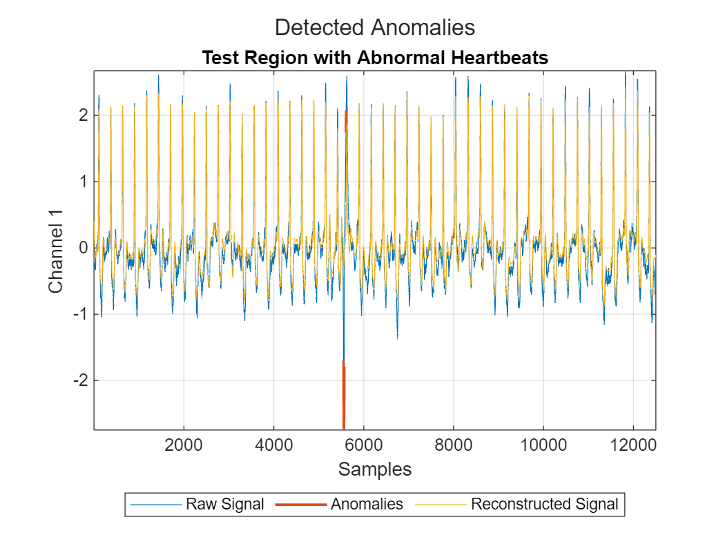 Detect Anomalies in Signals Using deepSignalAnomalyDetector