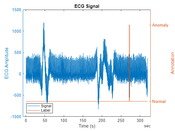 Figure contains an axes object. The axes object with title ECG Signal, xlabel Time (s), ylabel Annotation contains 2 objects of type line. These objects represent Signal, Label.