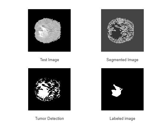 Figure contains 4 axes objects. Hidden axes object 1 with xlabel Test Image contains an object of type image. Hidden axes object 2 with xlabel Segmented Image contains an object of type image. Hidden axes object 3 with xlabel Tumor Detection contains an object of type image. Hidden axes object 4 with xlabel Labeled image contains an object of type image.