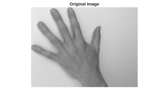 Figure contains an axes object. The hidden axes object with title Original Image contains an object of type image.