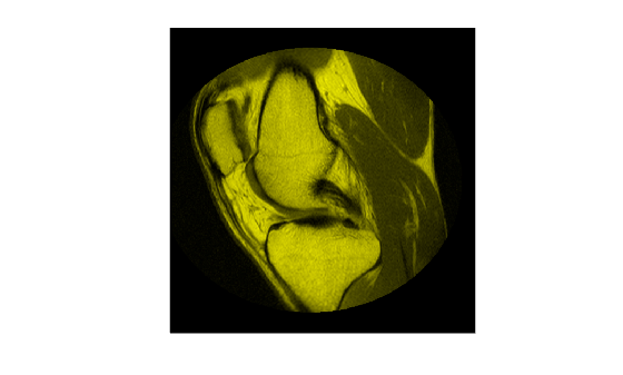 Figure contains an axes object. The hidden axes object contains an object of type image.