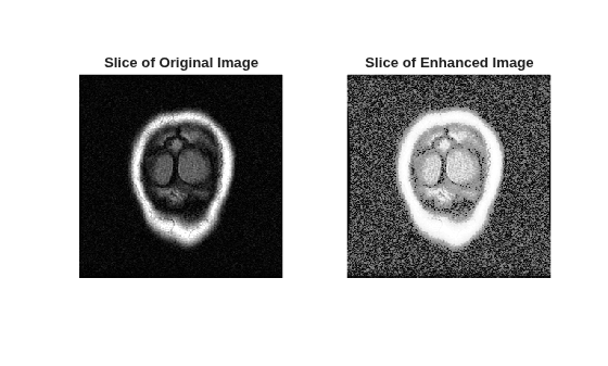 Figure contains 2 axes objects. Hidden axes object 1 with title Slice of Original Image contains an object of type image. Hidden axes object 2 with title Slice of Enhanced Image contains an object of type image.