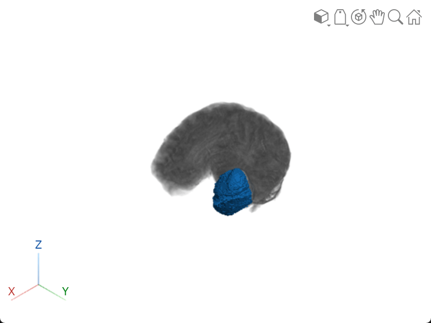 Viewer window, showing the effect of copying the clipping planed into the volume object. Three quadrants of the brain are visible, and the surface is fully visible.