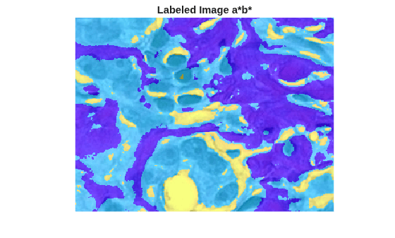 Color-Based Segmentation Using K-Means Clustering