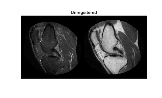Register Multimodal MRI Images