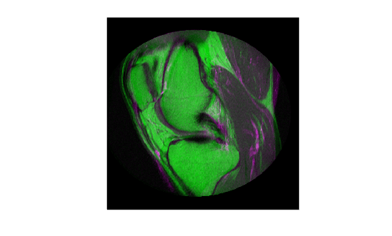 Figure contains an axes object. The hidden axes object contains an object of type image.