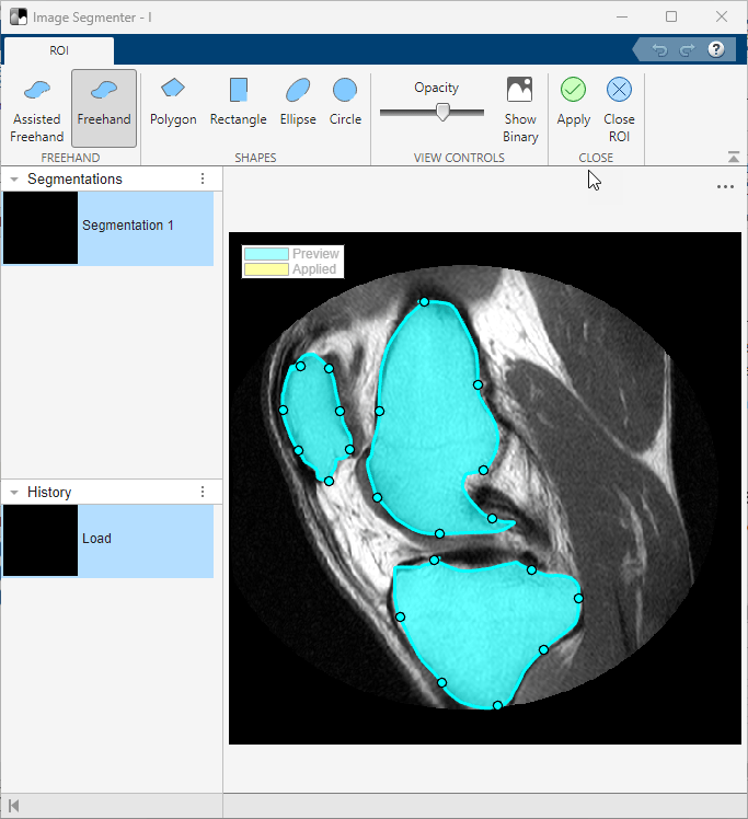 The ROI tab is open and the Freehand option is selected. The three segments have been defined and are filled in.