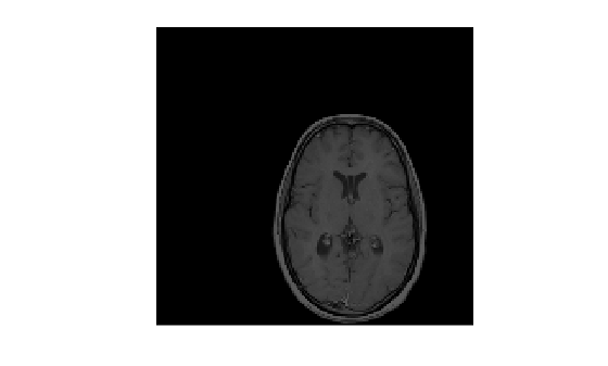 Figure contains an axes object. The hidden axes object contains an object of type image.