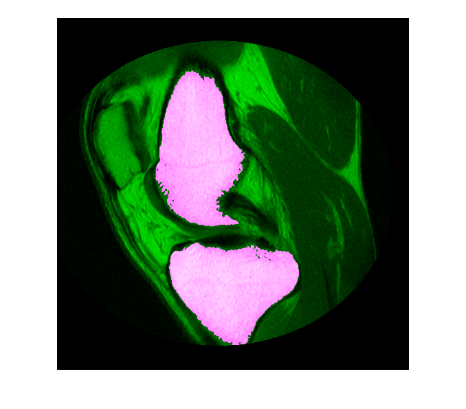 Use Freehand ROIs to Refine Segmentation Masks