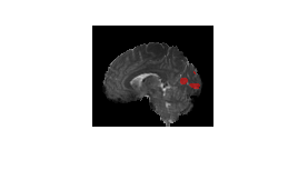 Compute Functional Connectivity from Brain fMRI