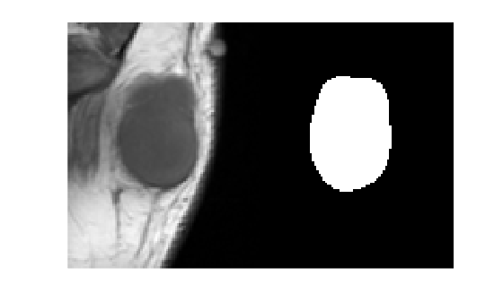 Figure contains an axes object. The hidden axes object contains an object of type image.