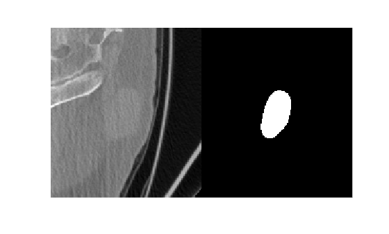 Figure contains an axes object. The hidden axes object contains an object of type image.