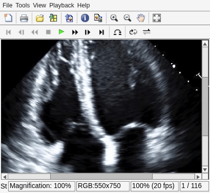 Figure Movie Player contains an axes object and other objects of type uiflowcontainer, uimenu, uitoolbar. The hidden axes object contains an object of type image.