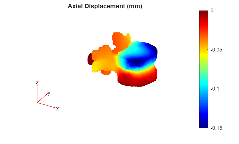 Medical Image-Based Finite Element Analysis of Spine