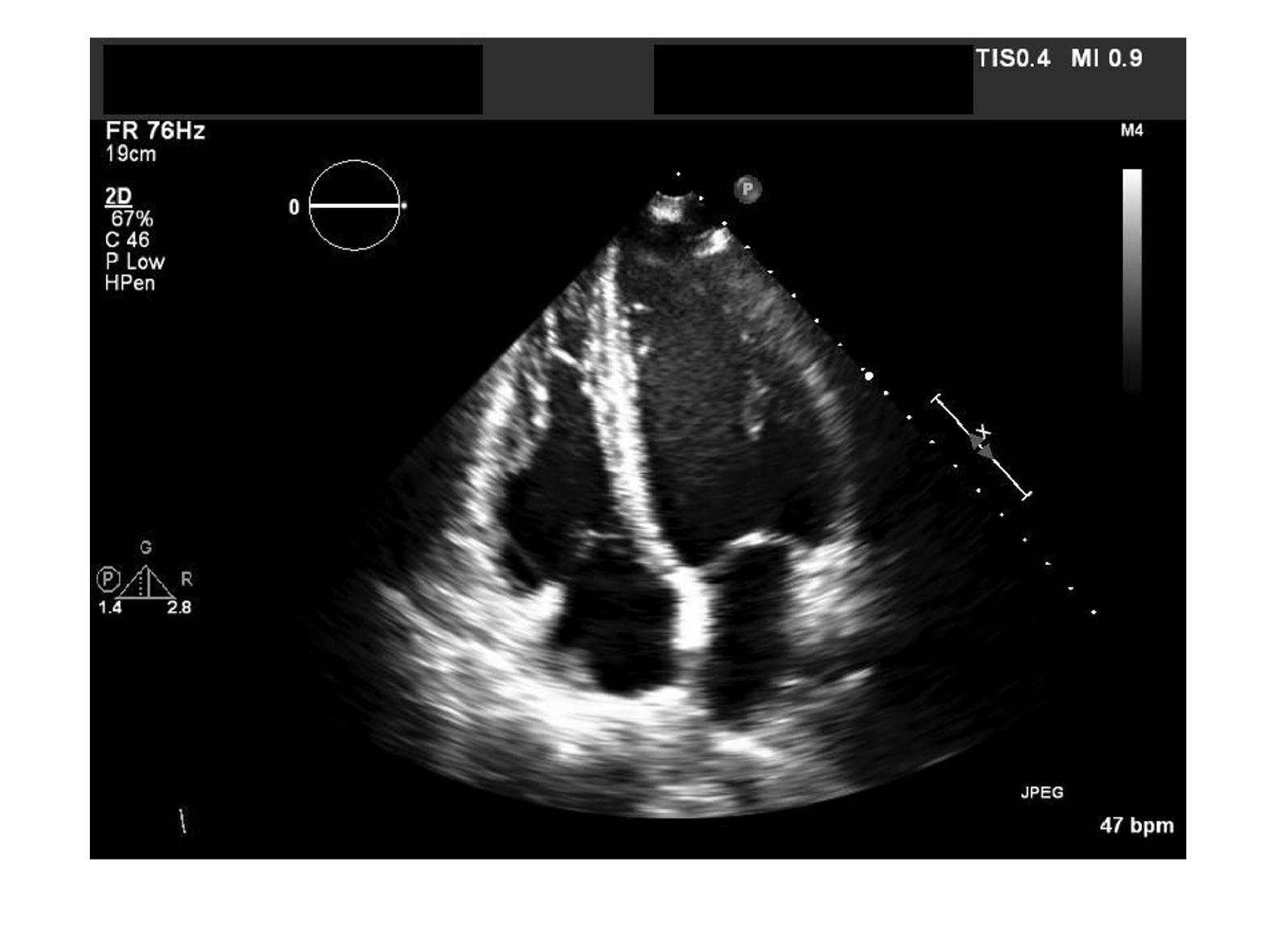 Read, Process, and View Ultrasound Data
