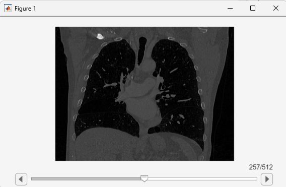 Slice viewer window, showing coronal slices in a scrollable figure window