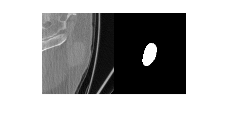 Figure contains an axes object. The hidden axes object contains an object of type image.