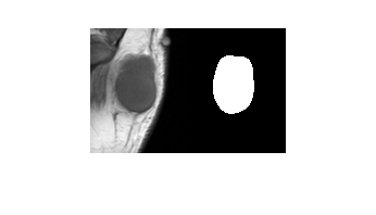 Figure contains an axes object. The hidden axes object contains an object of type image.