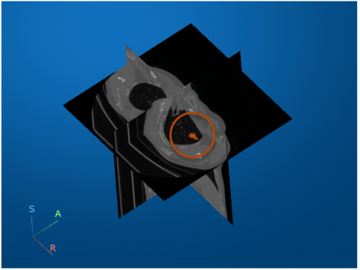 Display Labeled Medical Image Volume in Patient Coordinate System