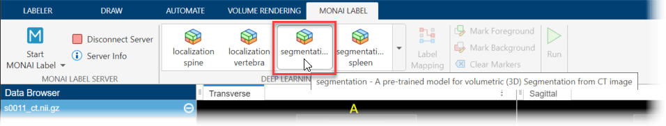 Label Mapping dialog box, with the spleen, kidney_right, kidney_left, liver, and lung labels selected and mapped to the Create New label definition option.