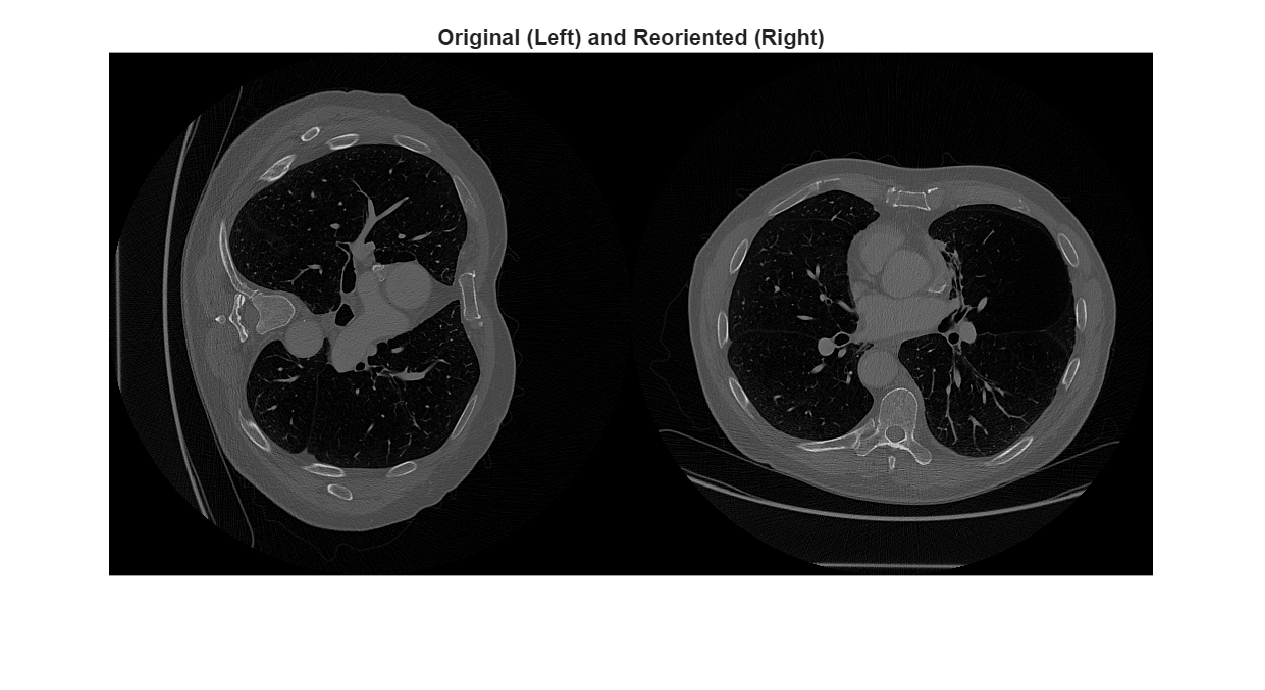 Figure contains an axes object. The hidden axes object with title Original (Left) and Reoriented (Right) contains an object of type image.