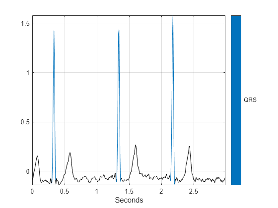 Figure contains an axes object. The axes object with xlabel Seconds contains 2 objects of type line.