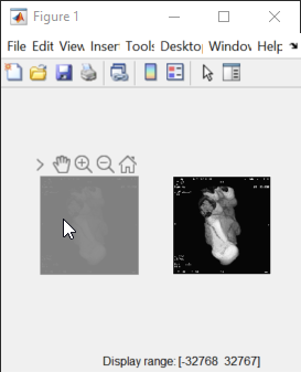 Unscaled and scaled DICOM image side by side in a figure window with the Display Range tool visible