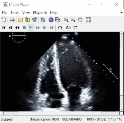 Play 2-D image series using the implay function